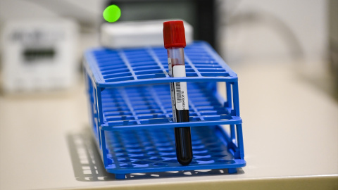 Una muestra de sangre en una clínica de Bruselas, a 23 de febrero de 2021. Una muestra de sangre en una clínica de Bruselas, a 23 de febrero de 2021.