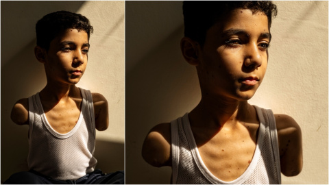 foto del año world press photo El niño Mahmoud Ajjour protagoniza la foto del año del World Press Photo.