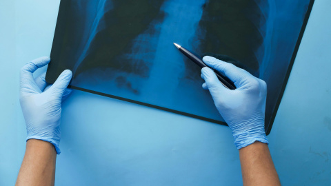 Tarde o temprano la mayoría de trabajadores pasan por un periodo de baja laboral.