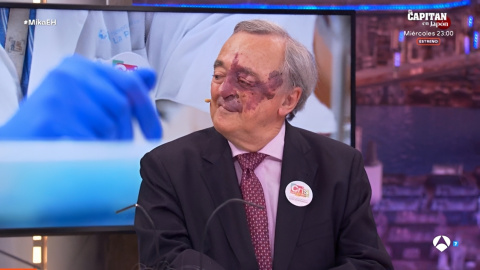 3/02/2026 El director del Grupo de Oncología Experimental en el CNIO, Mariano Barbacid, durante su intervención en 'El Hormiguero'. El director del Grupo de Oncología Experimental en el CNIO, Mariano Barbacid, durante su intervención en 'El Hormiguero'.