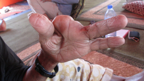 Detalle de la mano de un superviviente.