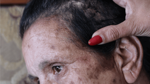 Najat Jadallah Emeid muestra la herida que tiene en la cabeza y los puntos que le tuvieron que poner tras la pelea con los colonos. Najat Jadallah Emeid muestra la herida que tiene en la cabeza y los puntos que le tuvieron que poner tras la pelea con los colonos.