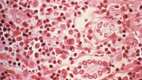 Vista microscópica de células infectadas con hantavirus.