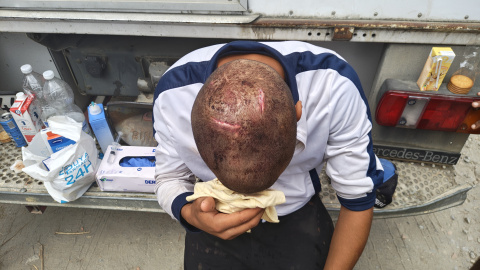 Un hombre con una brecha en la cabeza en el campamento de El Trampolín.