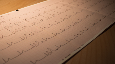 Electrocardiograma