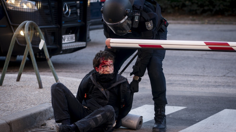 EuropaPress_7844106_alumno_herido_cargas_policiales_manifestacion_campus_ciudad_universitaria (1) Un alumno herido por las cargas policiales durante una manifestación en el campus de Ciudad Universitaria, a 14 de octubre de 2026, en Madrid.