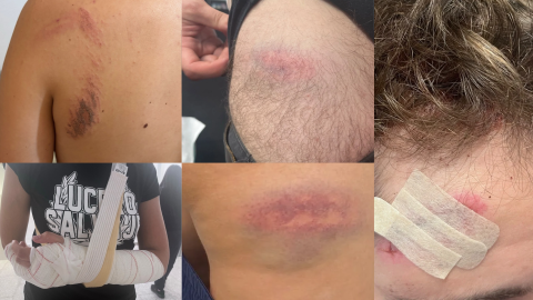 La Organización Estudiantil Socialista (OES) y la Coordinadora Juvenil Socialista (CJS) han facilitado a Público imágenes de varias personas heridas durante las cargas policiales en la Complutense.