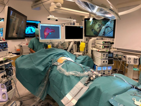 Preparados para iniciar la cirugía en el proyecto HIPERNAV. En la pantalla central, el hígado en 3D. Proyecto Hipernav, Author provided