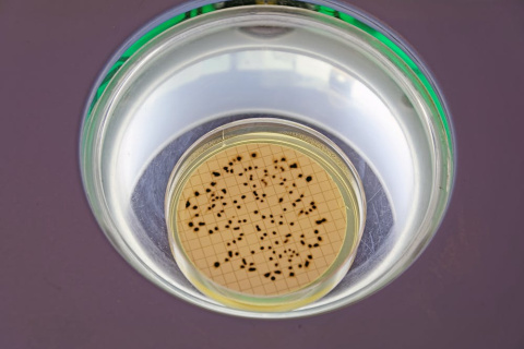 Esporas de Clostridium perfringens. Shutterstock / Pen_85