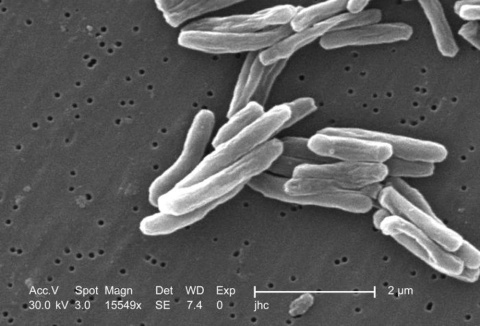 Mycobacterium tuberculosis. Wikimedia Commons / CDC/ Dr. Ray Butler; Janice Carr