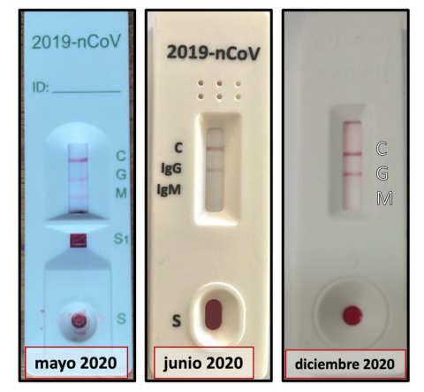 La evolución de los anticuerpos de Asun: la imagen izquierda es del décimo día tras la aparición de síntomas. Se detecta presencia de IgM e IgG. Una vez, recuperada, al mes siguiente de la enfermedad ya sólo se detecta IgG (imagen central), y el pas