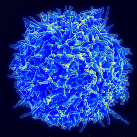 1200px-Healthy_Human_T_Cell.jpg