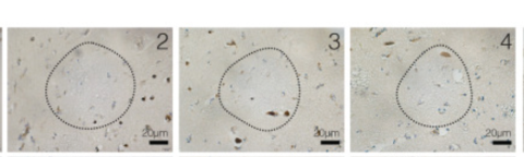 Fuente: https://pubmed.ncbi.nlm.nih.gov/33433624/ Fuente: https://pubmed.ncbi.nlm.nih.gov/33433624/