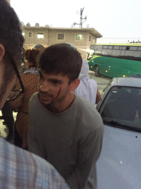 Activista español herido durante el desalojo de las casas demolidas