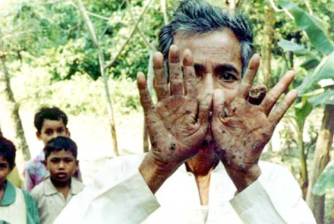 Efectos del arsénico en el agua potable.