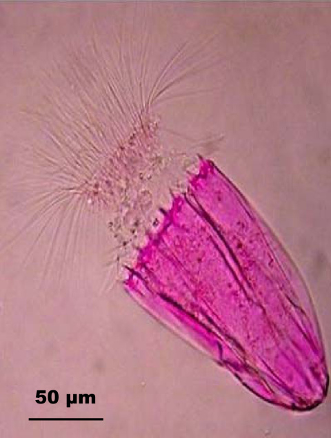 Spinoloricus nov. sp.