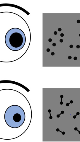 Esquema del tamaño de la pupila ante imágenes diferentes. Esquema del tamaño de la pupila ante imágenes diferentes.