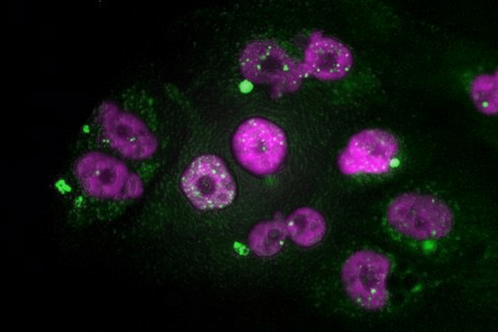 Una vacuna experimental de ARN muestra resultados prometedores en el cáncer de páncreas