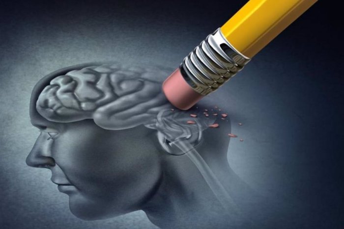 Un escáner cerebral de imágenes por resonancia magnética puede diagnosticar el alzhéimer precoz con un 98% de éxito