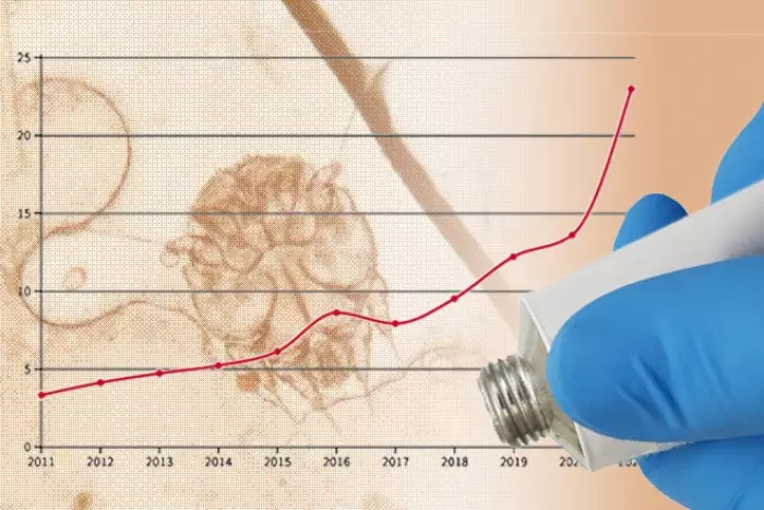 La sarna se dispara en España y los expertos no saben por qué: en 2022 se recetaron más cremas que nunca para tratarla