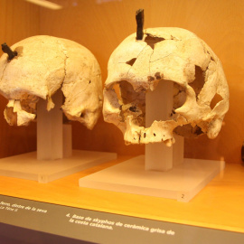 Dos cranis perforats, en una imatge d'arxiu