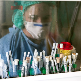 Tubos con muestras para análisis. EFE