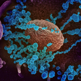 Imagen de microscopio electrónico que muestra (objetos en azul) al SARS-CoV-2, el virus que causa el brote del coronavirus COVID-19, emergiendo de la superficie de las células cultivadas en el laboratorio. EFE/ NIAID-RML