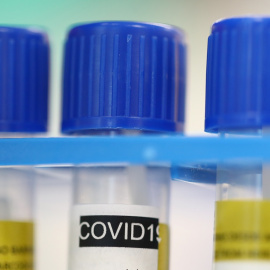 Tubo de pruebas en el Laboratorio de Microbiología del Hospital Universitario (CHUV)de Lausana (Suiza). REUTERS / Denis Balibouse