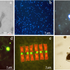 Virus y microorganismos marinos. a) virus; b) bacterias; c) protozoo (nanoflagelado heterotrófico); d) microalga (nanoflagelados fototrófico, con cloroplastos rojo-naranja) y protozoo (nanoflagelado heterotrófico, amarillo); e) microalgas (diatomeas); 