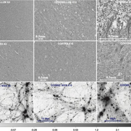 Mapas de contraste de densidad normalizada. Ejemplos de cortes del cerebelo (fila superior), de la corteza cerebral (fila del medio) y de la distribución de materia oscura de la red cósmica (fila inferior). Author provided