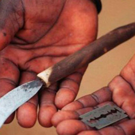 Mutilación genital femenina.