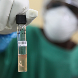 Técnico de Patología sostiene una muestra de cerebro obtenida mediante la técnica de la autopsia mínimamente invasiva (Foto: Quique Bassat) Author provided