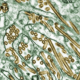 Los virus de la familia Orthomyxoviridae son los causantes de la gripe en los vertebrados, humanos incluidos. En esta microfotografía se muestra el virus H5N1 de gripe aviar (en amarillo) atacando células. Wikimedia Commons / Centers for Disease Control