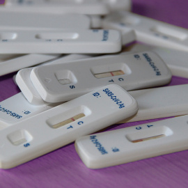  Test de antígenos.- Pixabay