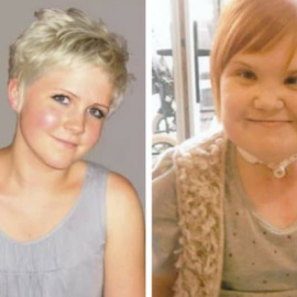  Las jovenes de 20 y 15 años que fallecieron en los ensayos clínicos.