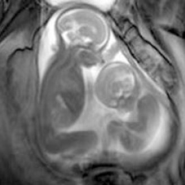  Crédito de la fotografía: Reuters