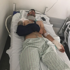 El ciclista herido EUROPA PRESS/BICICLETAS RODRÍGUEZ