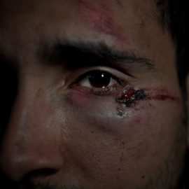  Crédito de la fotografía: Human Rights Watch