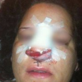 "Me habré recuperado de las lesiones físicas pero las secuelas de aquella tortura estarán siempre en mi cabeza"