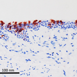  El virus ómicron (color rojo) infectando células de bronquios humanos (color azul). Fuente: Universidad de Hong Kong