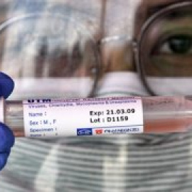 SOLIDARITY, el mayor ensayo clínico contra el coronavirus