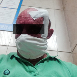 Imagen del sindicalista agredido por un grupo de ultraderecha en Málaga./ UGT