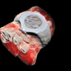 Radiografías de colores y otros resultados de los grandes aceleradores