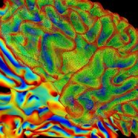 Errores que hicieron humano el cerebro humano