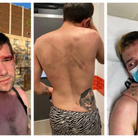 Imágenes de supuesto agredido por vigilantes de seguridad del hospital de Catelló.- ObservatoriLGTBIfobia