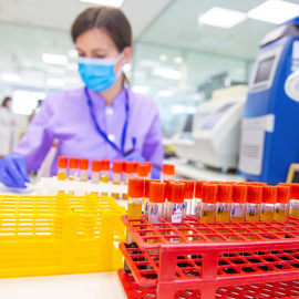 Los muertos por coronavirus bajan este sábado a 48. España suma 2,2 millones de pruebas PCR. / EFE