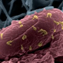 Los científicos se preguntan si los grandes virus son organismos vivos