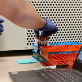 Francisco Soto, asistente de investigación en la Universidad de Arizona, prepara muestras de sangre para la prueba de anticuerpos para la enfermedad por coronavirus (COVID-19) en Tucson, Arizona, EE. UU., 10 de julio de 2020. REUTERS / Cheney Orr