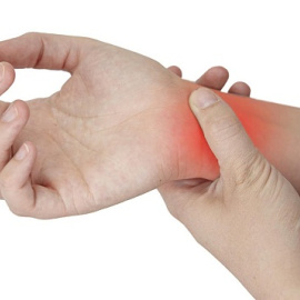 Síndrome del túnel carpiano.