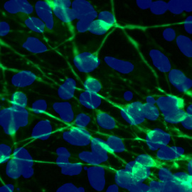 Neuronas normales tintadas para distinguir su cuerpo (en azul) de los axones (en verde)./SALK INSTITUTE